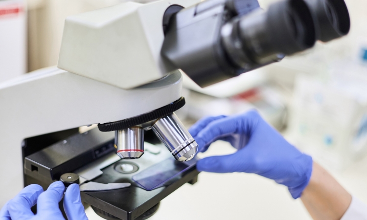 BIOPSIA PER ESAME CITOLOGICO E BIOPSIA PER ESAME ISTOLOGICO: DI COSA PARLIAMO?